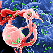 Scanning electron micrograph of HIV-1 virus budding (in green) from cultured lymphocyte.