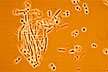 LLNL scientists have found a way to combat antibiotic resistant bacteria by using the bacteria's own genes.