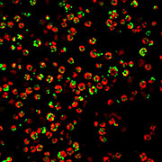 Algal cells of Chlamydomonas reinhardtii grown under nitrogen starvation conditions to produce lipids. The red is the autofluorescence from the chlorophyll of the cells while the green indicates the lipid bodies following lipid staining with Lipidtox Green. (Image prepared by Rita Kuo, DOE JGI.)
